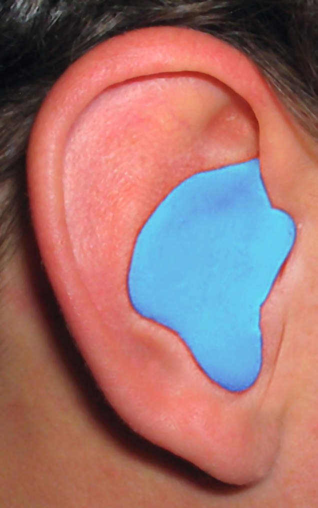 Radians Custom Molded Earplugs (BLUE, ORANGE, RED, PINK, TAN)/ Pair